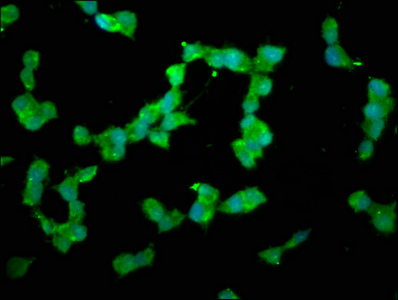 DUSP26 / MKP8 Antibody - Immunofluorescence staining of SH-SY5Y cells with DUSP26 Antibody at 1:200, counter-stained with DAPI. The cells were fixed in 4% formaldehyde, permeabilized using 0.2% Triton X-100 and blocked in 10% normal Goat Serum. The cells were then incubated with the antibody overnight at 4°C. The secondary antibody was Alexa Fluor 488-congugated AffiniPure Goat Anti-Rabbit IgG(H+L).