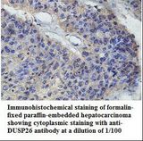 DUSP26 / MKP8 Antibody