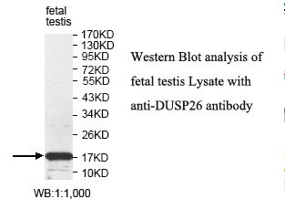 DUSP26 / MKP8 Antibody