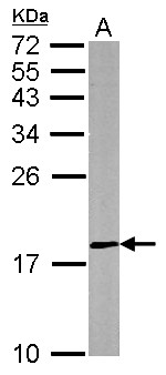 DUSP26 / MKP8 Antibody - Sample (50 ug of whole cell lysate). A: mouse brain. 12% SDS PAGE. MKP-8 / DUSP26 antibody diluted at 1:500.