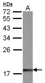 DUSP26 / MKP8 Antibody - Sample (30 ug of whole cell lysate). A: IMR32. 12% SDS PAGE. MKP-8 / DUSP26 antibody diluted at 1:500.