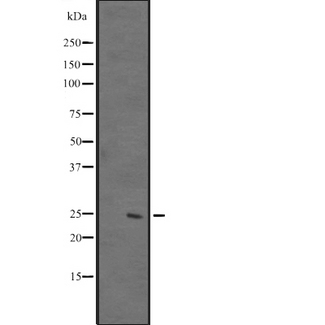 DUSP26 / MKP8 Antibody - Western blot analysis of DUSP26 expression in HeLa cells lysate. The lane on the left is treated with the antigen-specific peptide.