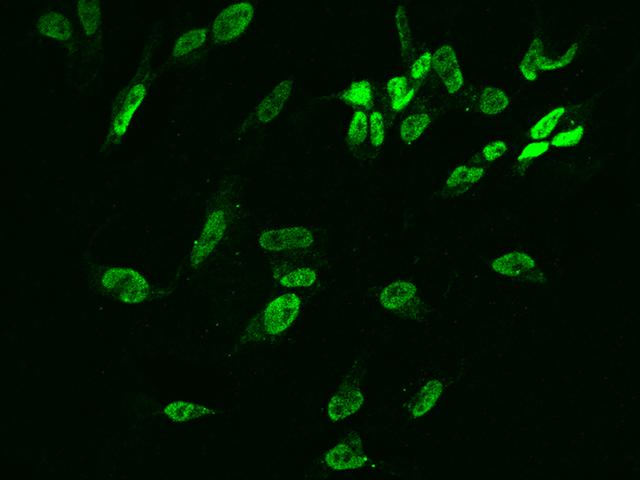 DUSP26 / MKP8 Antibody - Immunofluorescence staining of DUSP26 in SHSY5Y cells. Cells were fixed with 4% PFA, permeabilzed with 0.1% Triton X-100 in PBS, blocked with 10% serum, and incubated with rabbit anti-Human DUSP26 polyclonal antibody (dilution ratio 1:200) at 4°C overnight. Then cells were stained with the Alexa Fluor 488-conjugated Goat Anti-rabbit IgG secondary antibody (green). Positive staining was localized to Nucleus.