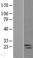 DUSP26 / MKP8 Protein - Western validation with an anti-DDK antibody * L: Control HEK293 lysate R: Over-expression lysate