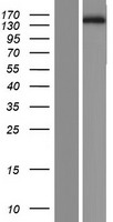 DUSP27 Protein - Western validation with an anti-DDK antibody * L: Control HEK293 lysate R: Over-expression lysate