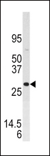 DUSP3 / VHR Antibody - Western blot of anti-DUSP3 antibody in SK-BR-3 cell line lysate.DUSP3(arrow) was detected using the purified antibody.