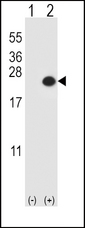 DUSP3 / VHR Antibody - Western blot of DUSP3 (arrow) using rabbit polyclonal DUSP3 Antibody (E6). 293 cell lysates (2 ug/lane) either nontransfected (Lane 1) or transiently transfected (Lane 2) with the DUSP3 gene.
