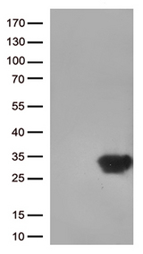 DUSP3 / VHR Antibody - HEK293T cells were transfected with the pCMV6-ENTRY control. (Left lane) or pCMV6-ENTRY DUSP3. (Right lane) cDNA for 48 hrs and lysed. Equivalent amounts of cell lysates. (5 ug per lane) were separated by SDS-PAGE and immunoblotted with anti-DUSP3. (1:500)