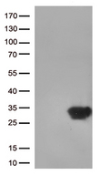 DUSP3 / VHR Antibody - HEK293T cells were transfected with the pCMV6-ENTRY control. (Left lane) or pCMV6-ENTRY DUSP3. (Right lane) cDNA for 48 hrs and lysed. Equivalent amounts of cell lysates. (5 ug per lane) were separated by SDS-PAGE and immunoblotted with anti-DUSP3. (1:500)