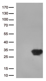 DUSP3 / VHR Antibody - HEK293T cells were transfected with the pCMV6-ENTRY control. (Left lane) or pCMV6-ENTRY DUSP3. (Right lane) cDNA for 48 hrs and lysed