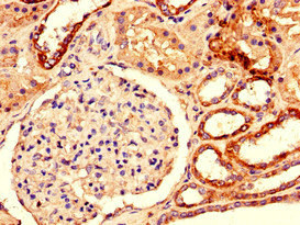 DUSP3 / VHR Antibody - Immunohistochemistry of paraffin-embedded human kidney tissue using DUSP3 Antibody at dilution of 1:100