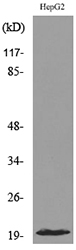 DUSP3 / VHR Antibody - Western blot analysis of lysate from HepG2 cells, using DUSP3 Antibody.