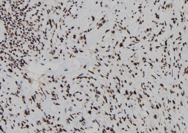 DUSP3 / VHR Antibody - 1:100 staining human gastric tissue by IHC-P. The sample was formaldehyde fixed and a heat mediated antigen retrieval step in citrate buffer was performed. The sample was then blocked and incubated with the antibody for 1.5 hours at 22°C. An HRP conjugated goat anti-rabbit antibody was used as the secondary.