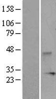 DUSP3 / VHR Protein - Western validation with an anti-DDK antibody * L: Control HEK293 lysate R: Over-expression lysate