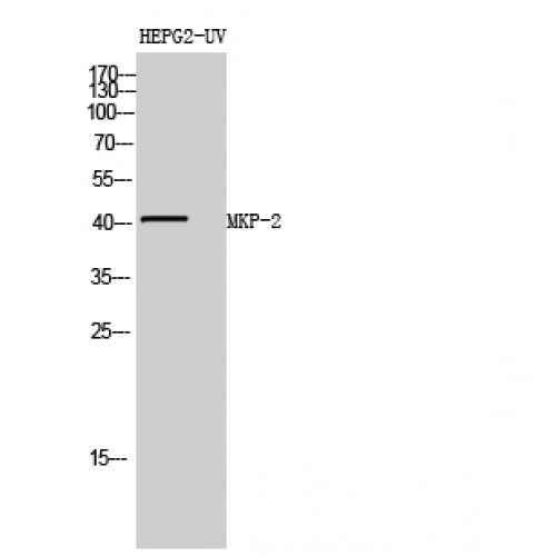 DUSP4 / MKP2 Antibody - Western blot of MKP-2 antibody