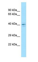DUSP4 / MKP2 Antibody - TYP / DUSP4 antibody Western Blot of COLO205.  This image was taken for the unconjugated form of this product. Other forms have not been tested.