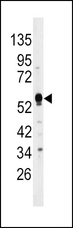 DUSP4 / MKP2 Antibody - Western blot of anti-DUSP4 Antibody in HepG2 cell line lysates (35 ug/lane). DUSP4 (arrow) was detected using the purified antibody.