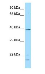 DUSP4 / MKP2 Antibody - TYP / DUSP4 antibody Western Blot of Fetal Brain.  This image was taken for the unconjugated form of this product. Other forms have not been tested.