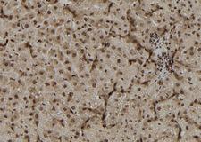 DUSP4 / MKP2 Antibody - 1:100 staining rat liver tissue by IHC-P. The sample was formaldehyde fixed and a heat mediated antigen retrieval step in citrate buffer was performed. The sample was then blocked and incubated with the antibody for 1.5 hours at 22°C. An HRP conjugated goat anti-rabbit antibody was used as the secondary.