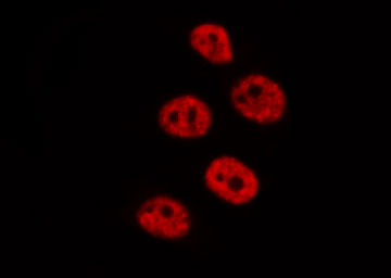 DUSP4 / MKP2 Antibody - Staining RAW264.7 cells by IF/ICC. The samples were fixed with PFA and permeabilized in 0.1% Triton X-100, then blocked in 10% serum for 45 min at 25°C. The primary antibody was diluted at 1:200 and incubated with the sample for 1 hour at 37°C. An Alexa Fluor 594 conjugated goat anti-rabbit IgG (H+L) Ab, diluted at 1/600, was used as the secondary antibody.