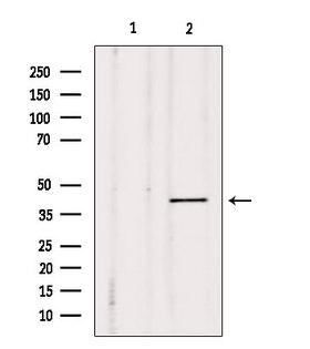 DUSP4 / MKP2 Antibody - Western blot analysis of extracts of mouse carcinoma using MKP-2 antibody. Lane 1 was treated with the blocking peptide.