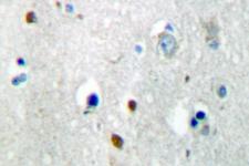 DUSP4 / MKP2 Antibody - IHC of MKP-2 (Y108) pAb in paraffin-embedded human brain tissue.