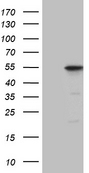 DUSP5 Antibody - HEK293T cells were transfected with the pCMV6-ENTRY control. (Left lane) or pCMV6-ENTRY DUSP5. (Right lane) cDNA for 48 hrs and lysed. Equivalent amounts of cell lysates. (5 ug per lane) were separated by SDS-PAGE and immunoblotted with anti-DUSP5. (1:2000)