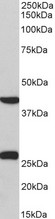 DUSP6 / MKP3 Antibody - Goat Anti-DUSP6 / MKP3 Antibody (0.3µg/ml) staining of Pig Heart lysate (35µg protein in RIPA buffer). Primary incubation was 1 hour. Detected by chemiluminescencence.