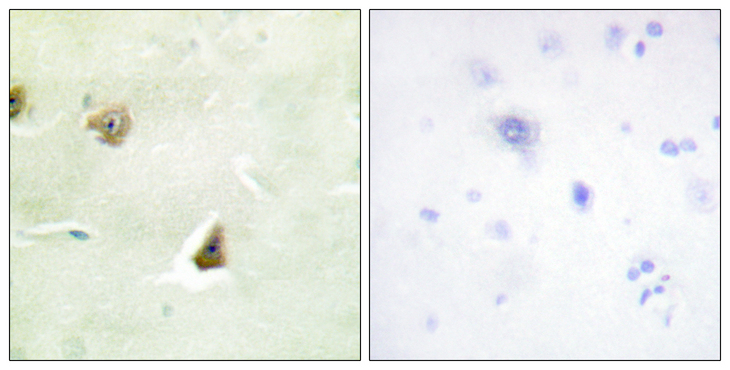DUSP6 / MKP3 Antibody - Immunohistochemistry analysis of paraffin-embedded human brain tissue, using DUSP6 Antibody. The picture on the right is blocked with the synthesized peptide.