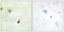 DUSP6 / MKP3 Antibody - Immunohistochemistry analysis of paraffin-embedded human brain tissue, using DUSP6 Antibody. The picture on the right is blocked with the synthesized peptide.