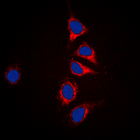 DUSP6 / MKP3 Antibody - Immunofluorescent analysis of DUSP6 staining in HepG2 cells. Formalin-fixed cells were permeabilized with 0.1% Triton X-100 in TBS for 5-10 minutes and blocked with 3% BSA-PBS for 30 minutes at room temperature. Cells were probed with the primary antibody in 3% BSA-PBS and incubated overnight at 4 deg C in a humidified chamber. Cells were washed with PBST and incubated with a DyLight 594-conjugated secondary antibody (red) in PBS at room temperature in the dark. DAPI was used to stain the cell nuclei (blue).