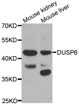 DUSP6 / MKP3 Antibody - Western blot analysis of extracts of various tissues.
