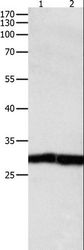 DUSP6 / MKP3 Antibody - Western blot analysis of Jurkat cell and human fetal kidney tissue, using DUSP6 Polyclonal Antibody at dilution of 1:450.