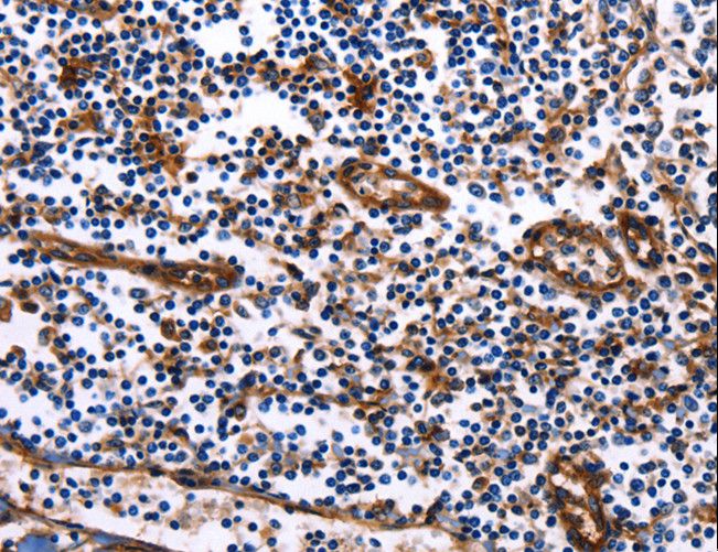 DUSP6 / MKP3 Antibody - Immunohistochemistry of paraffin-embedded Human tonsil using DUSP6 Polyclonal Antibody at dilution of 1:25.