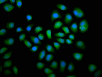 DUSP6 / MKP3 Antibody - Immunofluorescence staining of Hela cells with DUSP6 Antibody at 1:66, counter-stained with DAPI. The cells were fixed in 4% formaldehyde, permeabilized using 0.2% Triton X-100 and blocked in 10% normal Goat Serum. The cells were then incubated with the antibody overnight at 4°C. The secondary antibody was Alexa Fluor 488-congugated AffiniPure Goat Anti-Rabbit IgG(H+L).