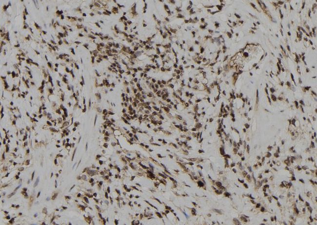 DUSP6 / MKP3 Antibody - 1:100 staining human gastric tissue by IHC-P. The sample was formaldehyde fixed and a heat mediated antigen retrieval step in citrate buffer was performed. The sample was then blocked and incubated with the antibody for 1.5 hours at 22°C. An HRP conjugated goat anti-rabbit antibody was used as the secondary.