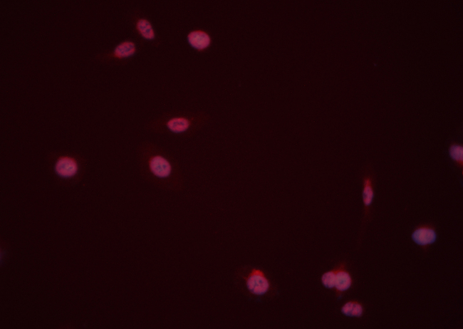 DUSP6 / MKP3 Antibody - Staining HeLa cells by IF/ICC. The samples were fixed with PFA and permeabilized in 0.1% Triton X-100, then blocked in 10% serum for 45 min at 25°C. The primary antibody was diluted at 1:200 and incubated with the sample for 1 hour at 37°C. An Alexa Fluor 594 conjugated goat anti-rabbit IgG (H+L) antibody, diluted at 1/600 was used as secondary antibody.