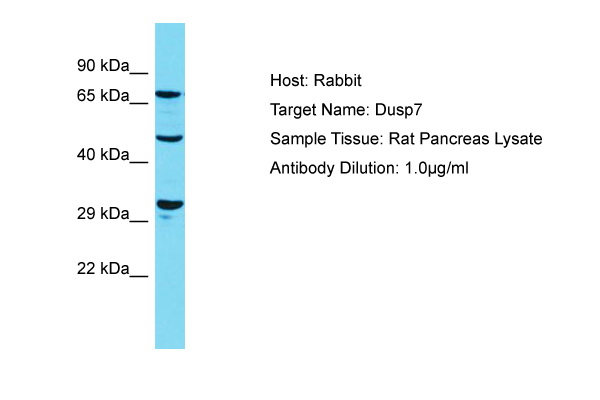 DUSP7 Antibody -  This image was taken for the unconjugated form of this product. Other forms have not been tested.