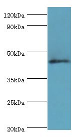 DUSP7 Antibody - Western blot. All lanes: Dual specificity protein phosphatase 7 antibody at 10 ug/ml+HepG2 whole cell lysate. Secondary antibody: Goat polyclonal to rabbit at 1:10000 dilution. Predicted band size: 45 kDa. Observed band size: 45 kDa Immunohistochemistry.