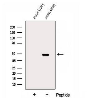 DUSP7 Antibody - Western blot analysis of extracts of mouse kidney tissue using DUSP7/PYST2 antibody. The lane on the left was treated with blocking peptide.