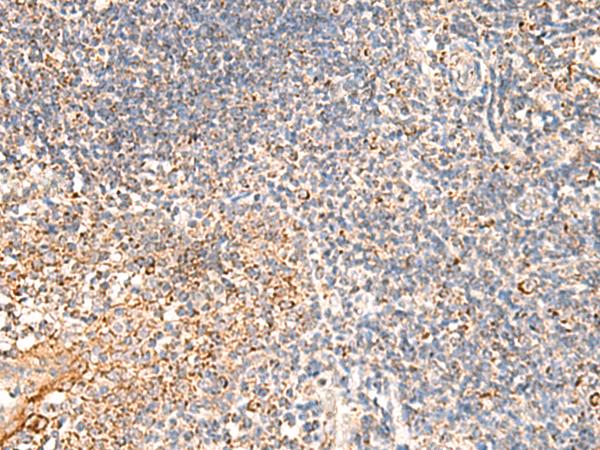 DUSP7 Antibody - Immunohistochemistry of paraffin-embedded Human tonsil tissue  using DUSP7 Polyclonal Antibody at dilution of 1:50(×200)
