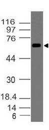 DUSP8 Antibody - Fig-1: Western blot analysis of DUSP8 . Anti-DUSP8  antibody was used at 1 µg/ml on Raji lysate.