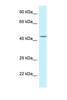 DUSP9 Antibody - DUSP9 antibody Western blot of Fetal Brain lysate. Antibody concentration 1 ug/ml.  This image was taken for the unconjugated form of this product. Other forms have not been tested.