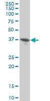 DUSP9 Antibody - DUSP9 monoclonal antibody (M04), clone 2E3 Western Blot analysis of DUSP9 expression in HeLa.