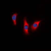 DUSP9 Antibody - Immunofluorescent analysis of DUSP9 staining in HeLa cells. Formalin-fixed cells were permeabilized with 0.1% Triton X-100 in TBS for 5-10 minutes and blocked with 3% BSA-PBS for 30 minutes at room temperature. Cells were probed with the primary antibody in 3% BSA-PBS and incubated overnight at 4 deg C in a humidified chamber. Cells were washed with PBST and incubated with a DyLight 594-conjugated secondary antibody (red) in PBS at room temperature in the dark. DAPI was used to stain the cell nuclei (blue).