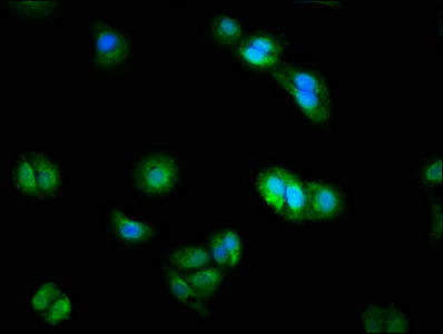 DUSP9 Antibody - Immunofluorescence staining of HepG2 cells with DUSP9 Antibody at 1:200, counter-stained with DAPI. The cells were fixed in 4% formaldehyde, permeabilized using 0.2% Triton X-100 and blocked in 10% normal Goat Serum. The cells were then incubated with the antibody overnight at 4°C. The secondary antibody was Alexa Fluor 488-congugated AffiniPure Goat Anti-Rabbit IgG(H+L).