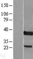 DUSP9 Protein - Western validation with an anti-DDK antibody * L: Control HEK293 lysate R: Over-expression lysate