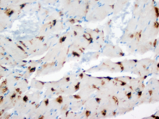 DUT / DUTPase Antibody - IHC analysis of DUT using anti-DUT antibody. DUT was detected in paraffin-embedded section of rat heart tissues. Heat mediated antigen retrieval was performed in citrate buffer (pH6, epitope retrieval solution) for 20 mins. The tissue section was blocked with 10% goat serum. The tissue section was then incubated with 1µg/ml rabbit anti-DUT Antibody overnight at 4°C. Biotinylated goat anti-rabbit IgG was used as secondary antibody and incubated for 30 minutes at 37°C. The tissue section was developed using Strepavidin-Biotin-Complex (SABC) with DAB as the chromogen.