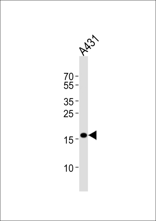 DUT / DUTPase Antibody - Western blot of lysate from A431 cell line, using DUT Antibody. Antibody was diluted at 1:1000 at each lane. A goat anti-rabbit IgG H&L (HRP) at 1:5000 dilution was used as the secondary antibody. Lysate at 35ug per lane.