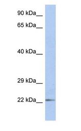 DUT / DUTPase Antibody - DUT / DUTPase antibody Western Blot of Fetal Small Intestine cell lysate.  This image was taken for the unconjugated form of this product. Other forms have not been tested.